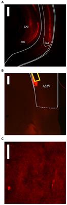 Chemogenetic inhibition of the ventral hippocampus but not its direct projection to the prelimbic cortex attenuates context-specific operant responding